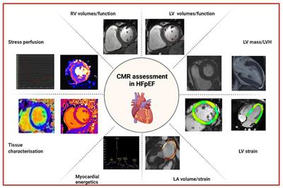 The role of cardiac magnetic resonance imaging in the assessment of heart failure with preserved ejection fraction